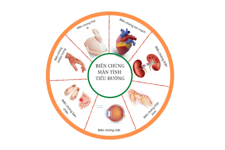 Bệnh tiểu đường biến chứng nguy hiểm như thế nào?